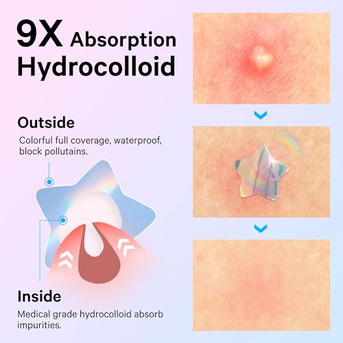 Sosky Hologram Pimple Patches for Face, Hydrocolloid Acne Patches with Salicylic Acid, Cute Star Zit Stickers,Colorful Blemish Covers,48 Count Blue Pink Star Heart Cloud Flower