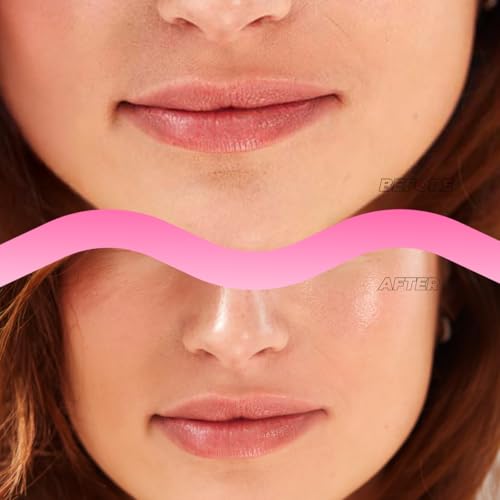 Instant Lip Filler Mask for Plumped Lips in 30 Mins with Vegan Collagen & Hyaluronic Acid - 3 Pack Korean Lip Mask Patches with 400 Dissolving Micro-Darts Tech for Instant & Long-Lasting Results