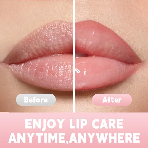 Anti Wrinkle Patches for Lips, Smoothing Smile Line & Lip Area Wrinkles, 6 Patches Skin-friendly Lip Lift Wrinkle Remover Patches