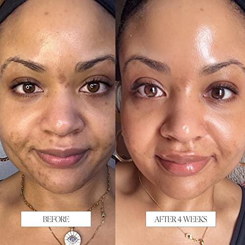 Byroe Exfoliating AHA Serum | Gentle Celery Serum for Resurfacing and Acne Prone Skin | Clarifying Pore Minimizer with Vitamin 12 Complex and LHA from Salicylic Acid | Vegan 30 ML