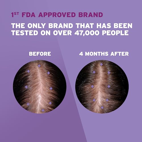 Women's Rogaine 2% Minoxidil Topical Solution for Hair Thinning and Loss, Topical Treatment for Women's Hair Regrowth, 3-Month Supply