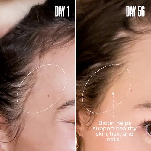 MA?LYS Super Charged Liquid Collagen for Women - Collagen Peptides Supplement with Biotin for Hair, Skin and Nails - Liquid Hydrolyzed Collagen Peptides