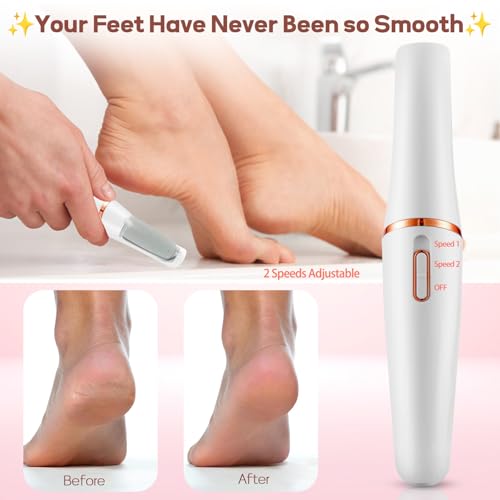 Electric Foot Callus Remover, Callus Remover for Feet Rechargeable Portable Pedicure Tool Kit, Smooth Pedicure Wand for Feet Care, Removes Dry Hard & Dead Skin Ideal Gift (White)