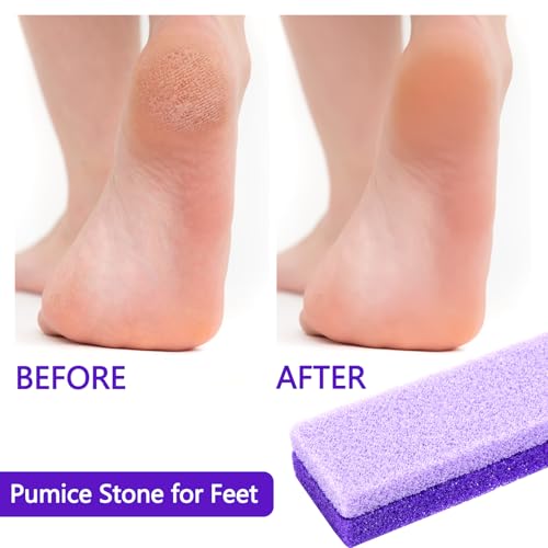 Pumice Stone for Feet 3 Pack ? Double Sided Foot Scrubber for Shower & Foot Bath, Foot Scrubber Dead Skin Remover