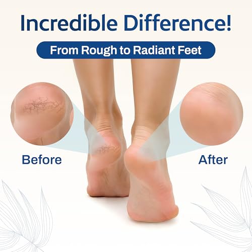 HartFelt Pedicure Exfoliation Beauty Box with 6 Exfoliating Foot Scrubber Bath Sponges & 2 Magic Pumice Stone for Feet Callus Remover | Gentle Sponge Pad & Foot Scrubbing Stone for Deep Cleansing