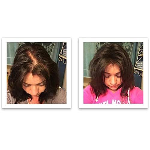 Caboki Hair Building Fiber + Built-In Spray Applicator (30-50 days supply). Dark Brown