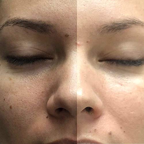 Luxury Exfoliator & Cleanser - Dual Action Deep Face Wash | Oil-Free Daily Facial Scrub 100ml