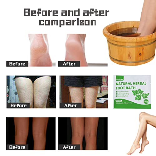 Natural Mugwort/Wormwood Herbal Foot Soak,Lymphatic Ginger Foot Bath Bag, Anti-Swelling Foot SPA Promote Metabolism, Foot Care 15g/PCS (64PCS)