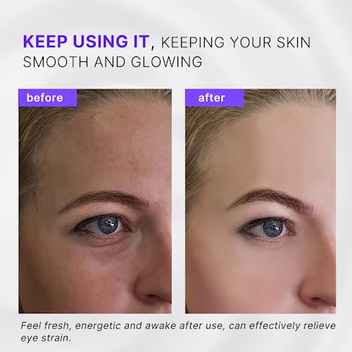 Eye Roller, Facial Roller Massager - Reduces Puffiness, Dark Circles, Cooling Therapy for Tired Eyes (with Applicator)