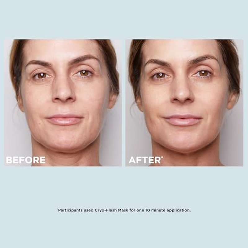 CLARINS Cryo-Flash Face Mask | Visible Lift Effect in 10 Minutes* | Visibly Minimizes Pores | Boosts Radiance | Pro Like Results | All Skin Types