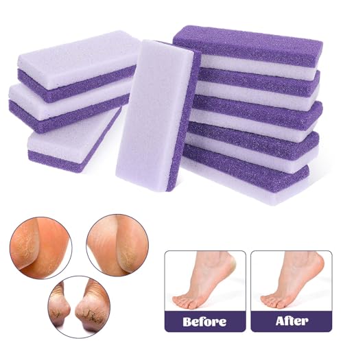6 Pcs Foot Pumice Stone Scrubber Professional Pedicure Ped File Scrubber Exfoliating Rock Pumice Stone for Smooth Feet and Heels Callus Removal and Dead Skins