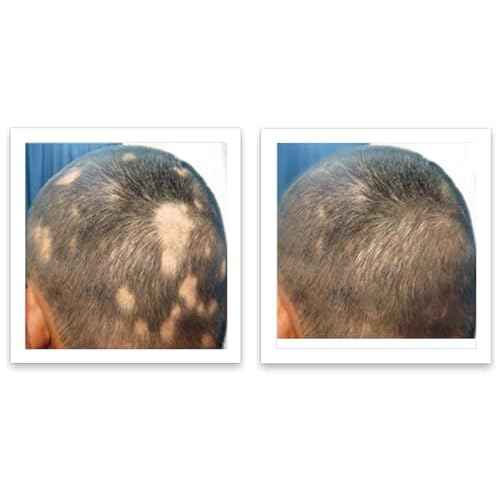 Caboki 10X Hair Powder for Thinning Hair, TALC-Free, Healthful Formula, Instantly Fuller Hair, Flawless Roots, Rain and Sweat Resistant, Easy to Use, Black, Unisex