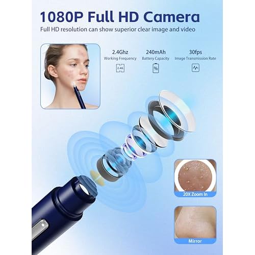 Visual Blackhead Remover Tools with Camera,Pimple Popper Extractor Tool Kit with Camera 20X 1080P Pore Cleaner Acne Comedone Whitehead Extractor Kit for iPhone/Android (Blue)