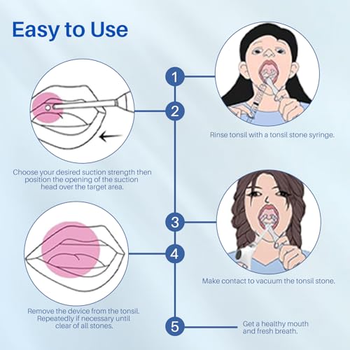 Upgraded Tonsil Stone Remover Tool - Rechargeable Tonsil Stone Vacuum with LED Light & 11-in-1 Probes, Instant Suction for Bad Breath Relief, Safe Silicone/Glass Tip for Tonsilloliths Removal