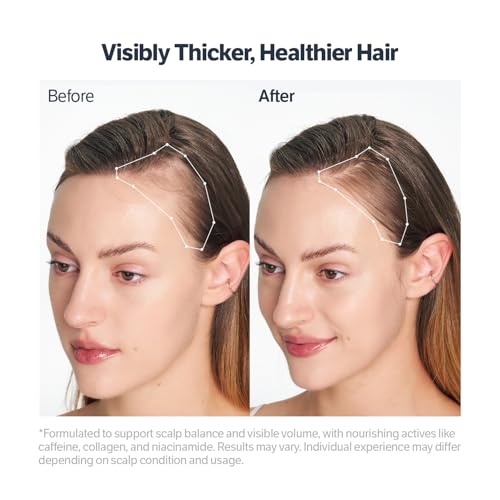 SUNGBOON EDITOR Deep Collagen Retinol Scalp Serum |Roll-On Hair Growth&Thickening Serum |Dry, Itchy Scalp Treatment |Caffeine +Biotin +Rosemary |Stocking Stuffers for Women |Korean Hair Care,0.5 fl oz