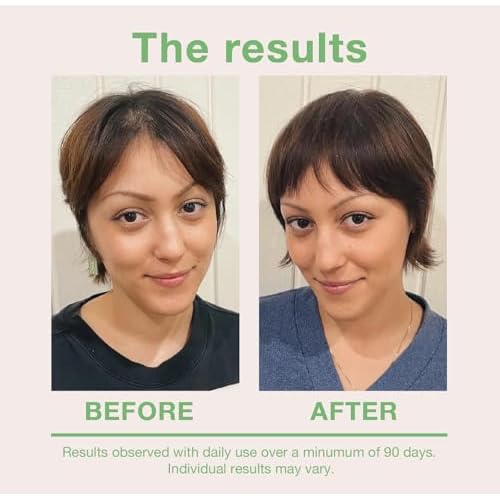 mumms Scalp Serum, Hair Growth Treatment with Saw Palmetto and Ginger Root, 2 fl oz, Daily Use