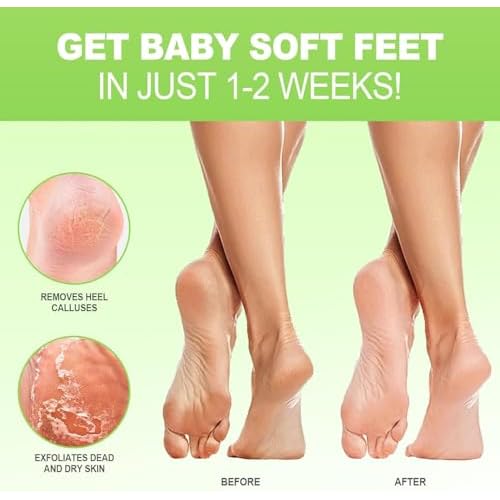 JVR Foot Peel Mask - 3 Pairs - Exfoliating Peeling Callus Remover, Repairs Cracked Heels & Dry Skin, for Smoother and Softer Feet (Aloe Vera)