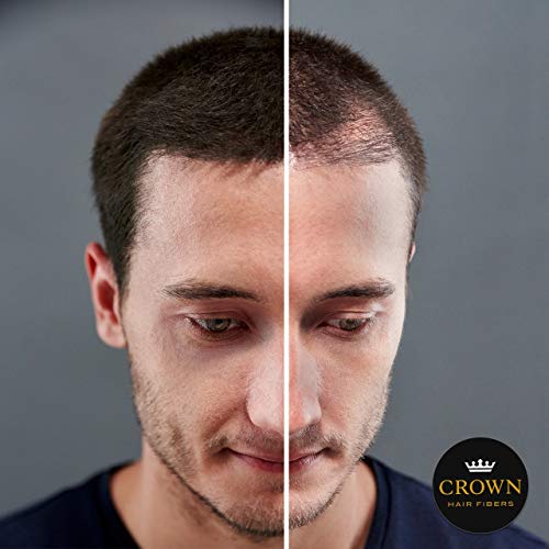 CROWN Hair Building Fibers (28g) - Instantly Cover Fine & Thinning Hair for a Thicker, Fuller Look - A Natural Keratin Concealer - 13 Shades for Men & Women - Black