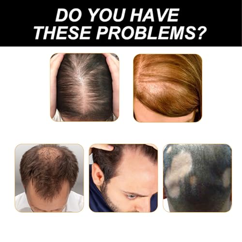 Stem Cell Complete Hair Growth Cycle Solution 2.0, Stem Cell & Multi-peptides Serum Ampoules for HairGrowth, Deep Repair for Thicker and Fuller Hair