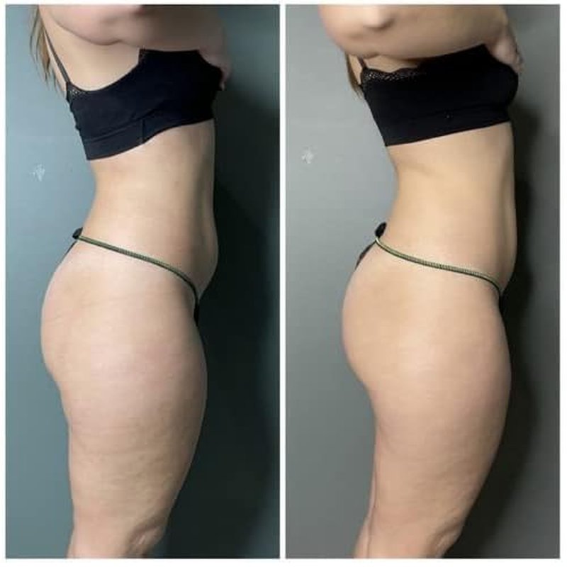 Guam Anti Cellulite Seaweed Wrap ORIGINAL FORMULA | Skin Tightening Cellulite Treatment For Thighs And Legs Inches Reduction - Hot Mud Thigh Wraps For Cellulite Removal, 1KG Beauty