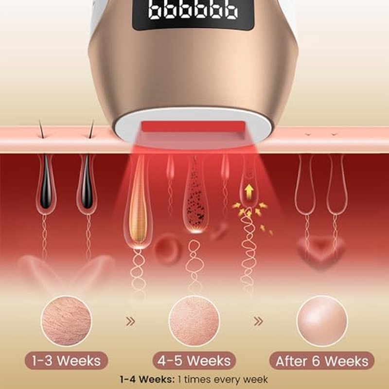 Hair Removal Device, Hair Removal for Women and Men£¬Hair Removal Body and Face for Home Use,model S3