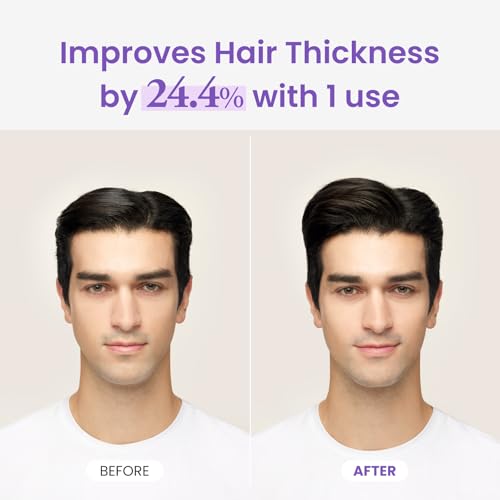 Dr.groot Rosemary Mint Oil Tonic for Hair Growth with Biotin, Hyaluronic Acid, Thickening & Scalp Nourishing. Korean Haircare. Sulfate-Free, Silicon-Free, Paraben-Free (3.38 fl oz/ 100ml)