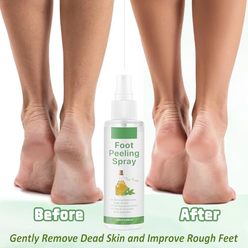 Foot Peeling Spray, Tea Tree Foot Exfoliator Spray, Vegan Botanicals, Moisturizing & Smooth Feet Skin, Gently Exfoliates Away Rough, Dry Skin, 4.06fl.oz/120ml