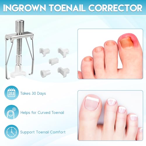 Ingrown Toenail Removal Kit, Professional Ingrown Toenail Tool Kit Includes Ingrown Toenail Corrector Drops, Corrector Patch, Toenail Clipper, Nail File Lifter Pedicure Tools