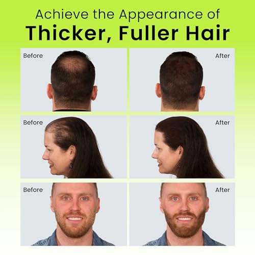 ECLIPSE Hair Fibers Dark Brown for Thinning Hair for Women & Men to Conceal Hair Loss in 15 Seconds - 100% Undetectable Hair Building Fibers, 15g