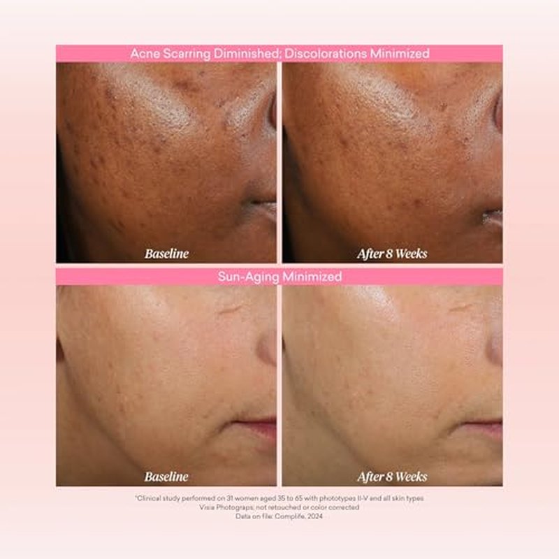 toty By Sofia Vergara - Reversa Retinol Photoage-Defying Serum - Anti-Aging to Reduce Lines and Wrinkles for Firm and Plump Skin - 0.5% Micro-Encapsulated Retinol, 5% Niacinamide, 2% NAG - 1.0 fl oz