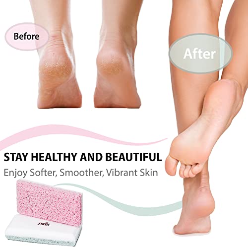 Siliglass Pumice Stone Callus Remover for Feet, Elbows, Hands, and Knees, Spain Made - 2 in 1 Pedicure Exfoliator and Scrubber for Rough, Hard Skin (1 Pack)