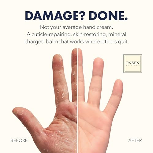 Onsen Hand & Cuticle Rescue Cream | Organic Nail Strengthener & Balm | Dry, Cracked Hands, Elbows & Feet | Shea Butter, Tsubaki & Jojoba Oil | Nail Repair & Growth, Vegan - 1 Pack (0.88 oz)