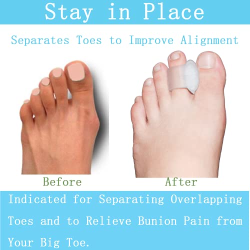Pack of 12 Gel Toe Separator, (1/4" Thick) Big Toe Spacers, Single Loop Toe Spreader for Bunions, Overlapping Toe, Corrector and Spacer (Clear)