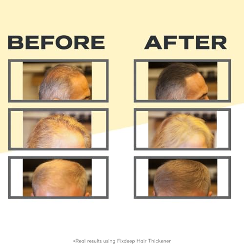 Hair Thickener | New Waterproof Formula - Natural & Fuller Looking Hair in 30 sec - 14g - Fibers for Thinning, Bald Spots & Graying Roots (Dark Brown)