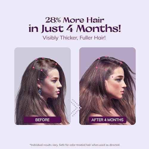 Women's 5% Minoxidil Spray for Hair Growth: RootStim Extra Strength Minoxidil with Rosemary & Biotin for Thinning Hair Regrowth and Fuller Hair 60 ML