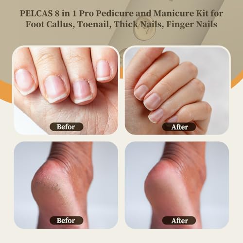 PELCAS 8 in 1 Cordless Nail Drill, Electric Nail Filer 5 Speeds Manicure & Pedicure Kit with LED Light, Electric Foot Callus Remover for Foot Callus, Toenail, Thick Nails, Finger Nails Golden