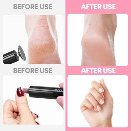 Electric Callus Remover for Feet, Electric Foot File Nail Grinder 2 in 1,Rechargeable Professional Foot Sander Pedicure Tool for Feet Dry Dead Skin with Sandpaper Disk, 9 Speed Adjustable (Black)