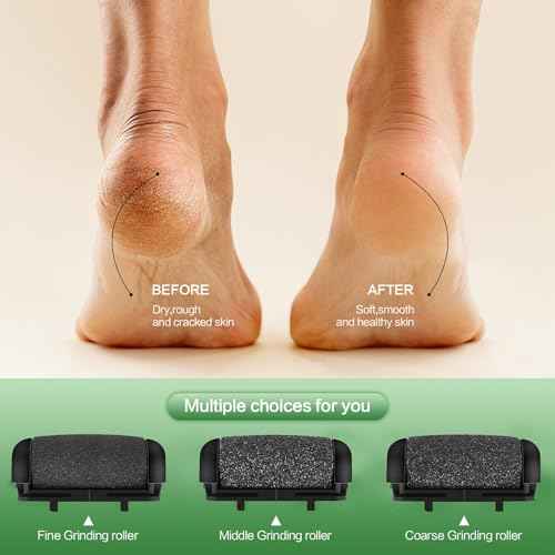 Electric Foot File Pedicure Feet Hard Skin Remover Foot Scraper Dry Dead Skin Remover Callus Exfoliator Rechargeable Feet Scrubber with 3 Replacement Rollers Foot Care Skin Removers, Black