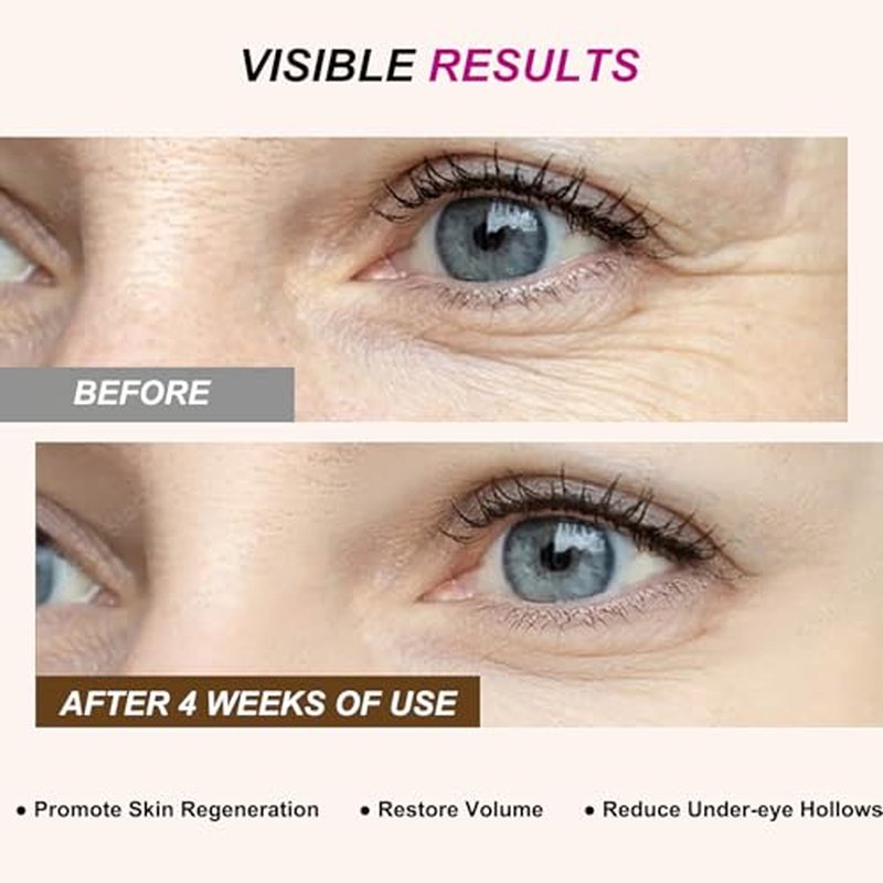 Calcium Volume Multi Balm,Intensive Repair & Moisturizing Cream,Hydrating,Firming Skin,Suitable for Eyes,Neck,Face,0.32 oz/9 g (Pack of 2)
