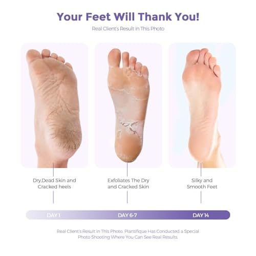 Foot Peel Mask, Lavender Foot Mask Natural Exfoliator for Dry Dead Skin, Callus, Peeling Foot Mask Repairs Heels & Removes Cracked Feet & Rough Heels Enjoy Baby Soft Smooth Feet