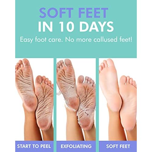 DERMAL KOREA Foot Peeling Mask 3 Pack For Dry Foot And Cracked Heel & Callus With Aloe Vera And Collagen - Exfoliating Peel Mask With Aha, Bha, & Pha And For Moisturizing, Soothing & Refreshing Feet