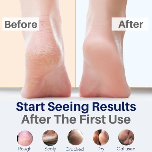 Yellow Bird Natural Tea Tree Foot Cream & Organic Foot Balm for Dry, Cracked Feet & Heels ? Peppermint Moisturizer for Athlete¡¯s Foot Relief and Intensive Callus Repair Treatment Salve ? Made in USA