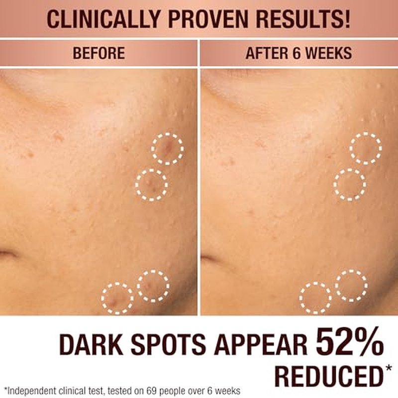 Charlotte Tilbury Radiance Recovery Dark Spot Serum - Dark Spot Corrector & Vitamin C Serum for a Brighter-Looking Complexion - Helps Reduce the Appearance of Redness & Uneven Skin Tone