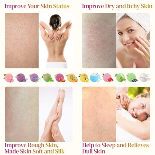 KIMHY Bath Bombs for Women, 12 PCS Bath Bombs for Girls Kids Toddlers Adults, Shea & Coco Butter Dry Skin Moisturize, Bath Bomb Kit for Birthday Halloween Christmas