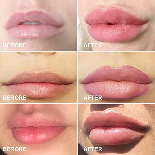 Lips Enhancer Plumper Device Lips Silicone Fish Shape Lip Plumper Lip Plumping Natural Pout Mouth Tool Sexy Lip Mouth Bigger