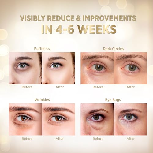 VELAMO ADVANCED Under Eye Patches: 24K Gold Under Eye Mask for Puffy - Retinol Patchology Eye Patches for Wrinkles and Dark Circles Puffiness- Collagen Under Eye Bags Treatment for Women Men 60 Pcs