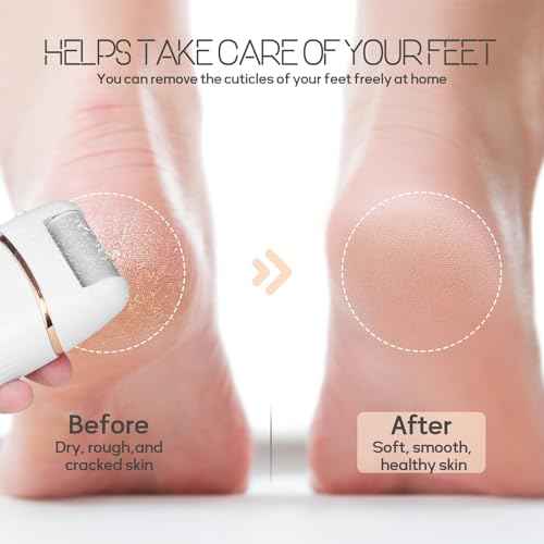 Automatic Callus Remover for Feet, Rechargeable Pedicure Tools for Feet, Electric Foot Callus Remover with 3 Roller Heads 2 Speed, Waterproof Foot File Perfect for Dead Hard Cracked Dry Skin