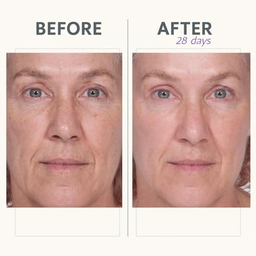 Reverse Lift Firming Facial Serum, Visibly Firm, Tone & Tighten Skin, Hydrating Anti-Aging Peptides, Reduce Wrinkles, Sagging Face and Neck, Serious Skincare, 1 oz