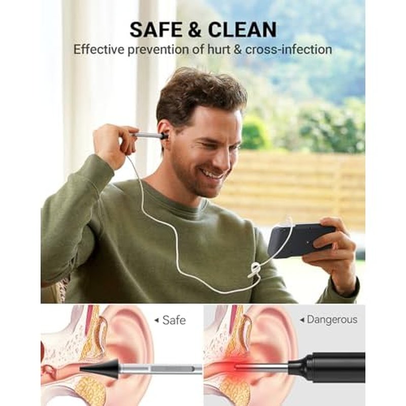 Anykit Digital Otoscope with Gyroscope, 4.5 Inches Screen, 3.9mm Ear Scope Camera with 6 Lights, Ear Wax Removal Tool, 32GB Card, Supports Photo Snap and Video Recording