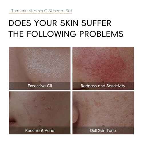 7PCS Turmeric Skin Care Set, Facial Skin Care Products Even Skin Tone, Turmeric Face Wash, Toner, Serum, Eye Cream, Face Cream, Face Mask, Smooth Glowing Travel Skincare Set for Women Girls